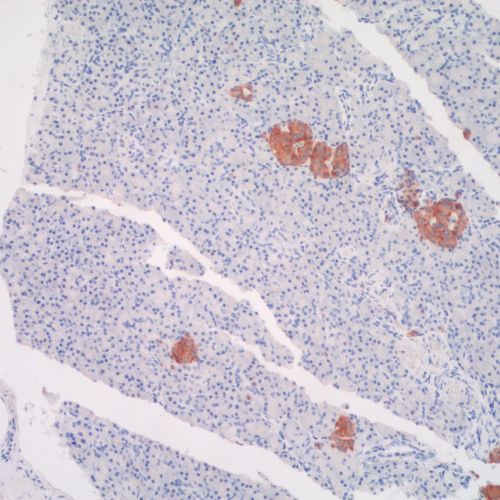 Pancreas 2014 1b 2014-12-04 SYNAP.jpg