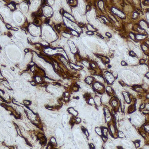 Amyloid 2012 3 2014-09-16 AMYA.jpg